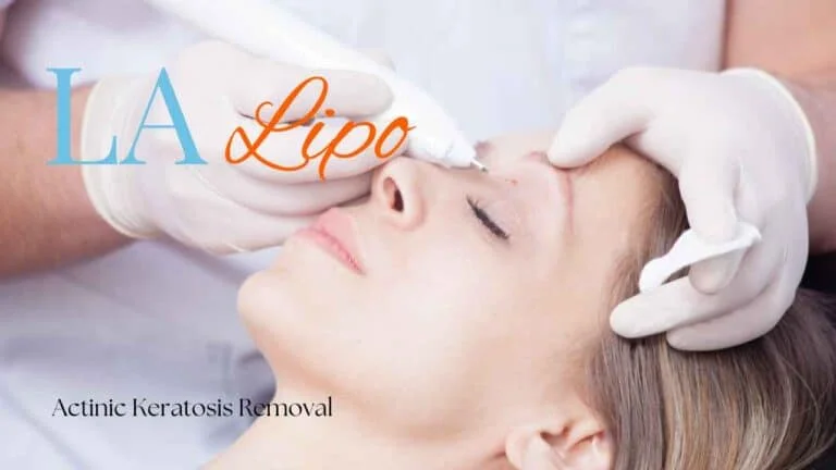 Woman receiving Actinic Keratosis Removal Treatment Wembley Park