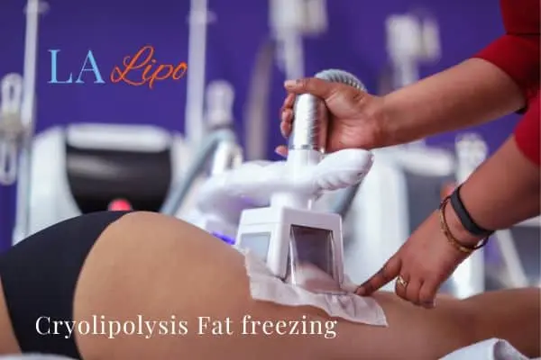 women getting fat freezing Wembley Park