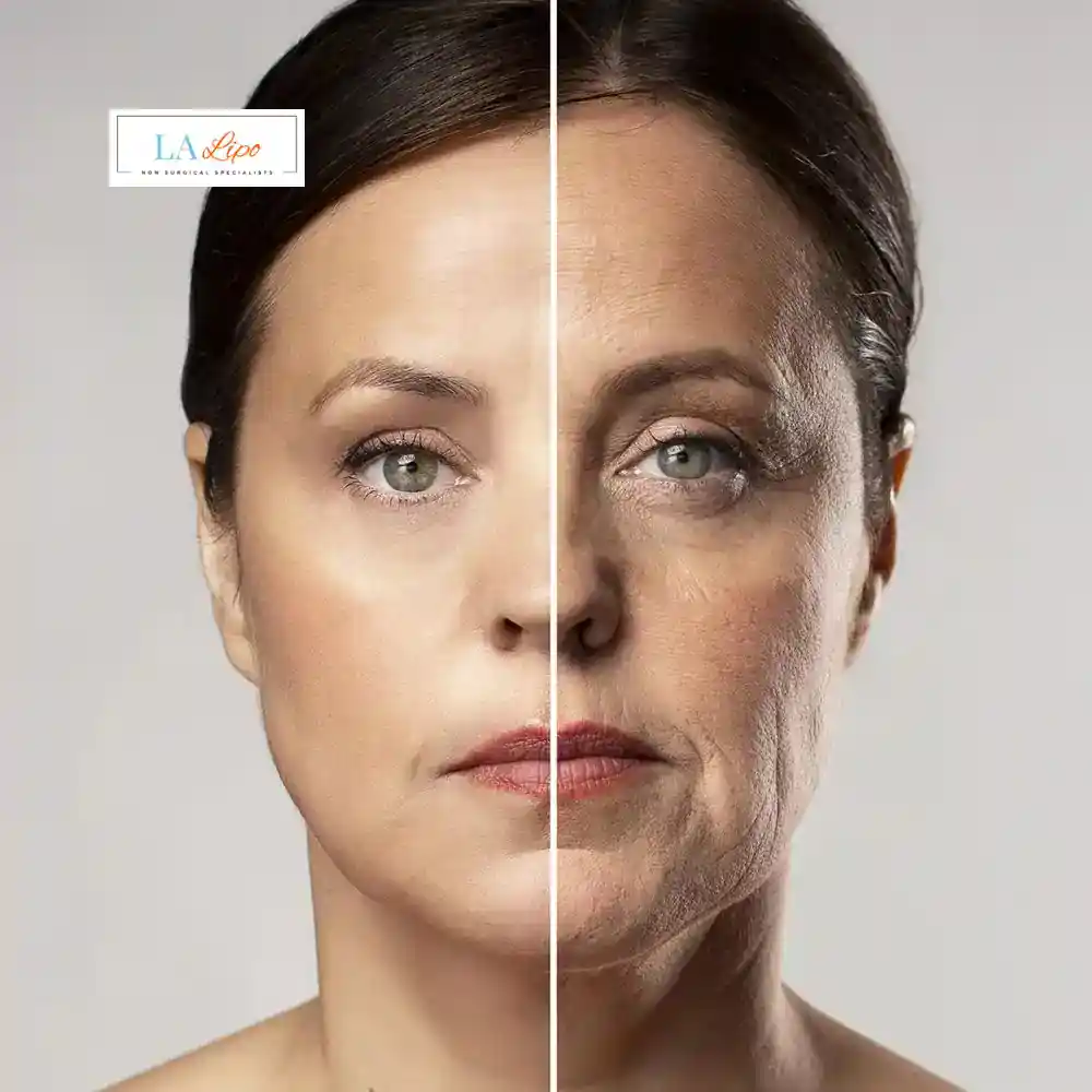 How Can You Tell If Non-Surgical Skin Tightening Is Right for You Wembley Park?