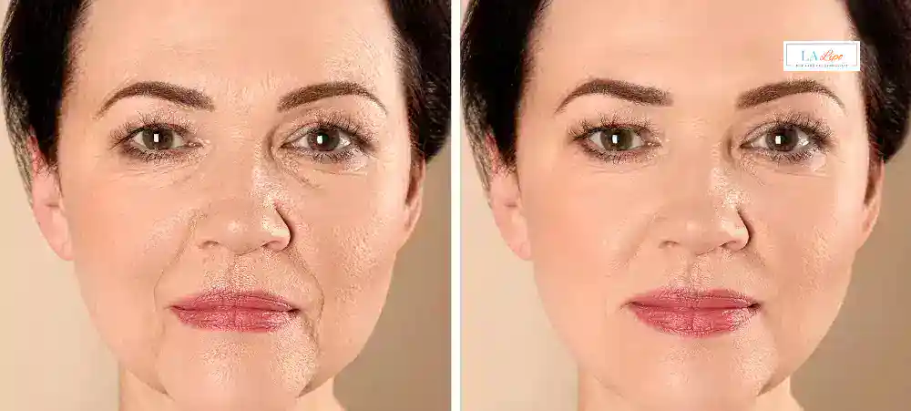 Why Aren’t My Skincare Products Making My Sagging Skin Look Firmer Wembley Park?