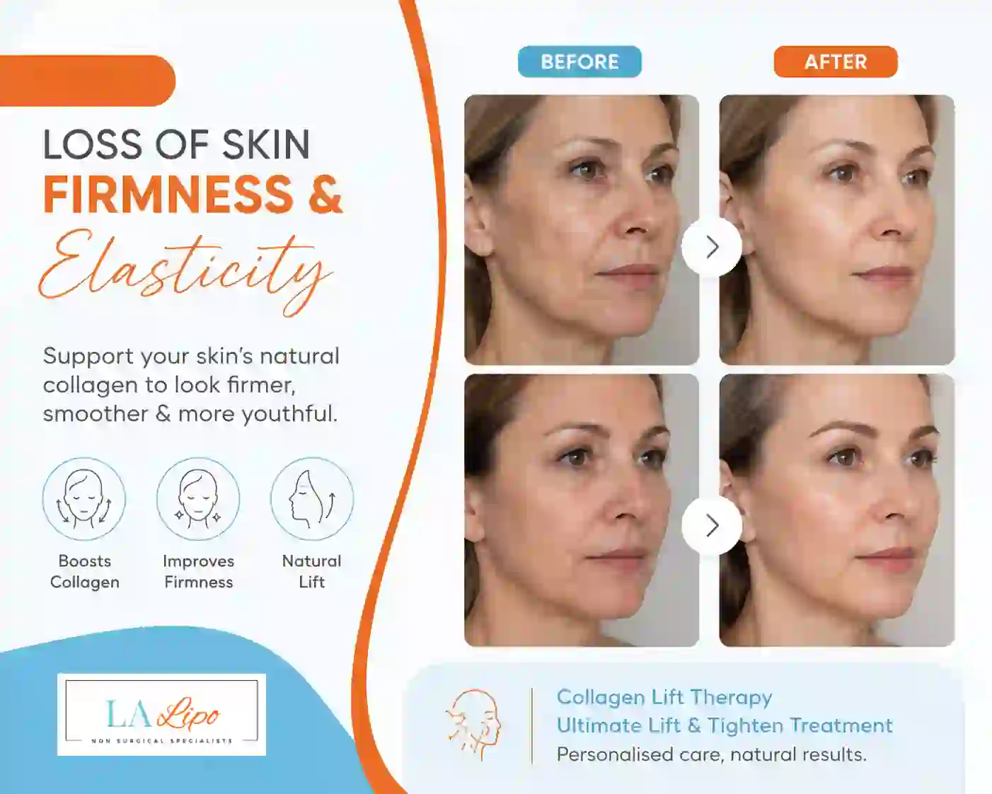 Sign #7: Loss of Skin Firmness and Elasticity Wembley Park