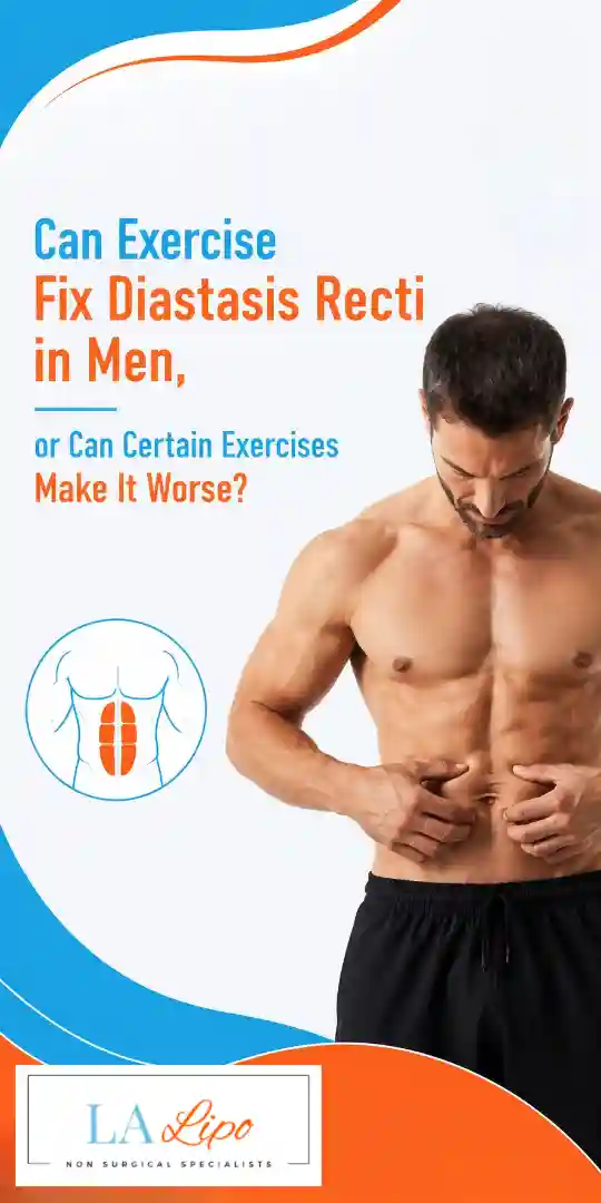 Can Exercise Fix Diastasis Recti in Men, or Can Certain Exercises Make It Worse Wembley Park?